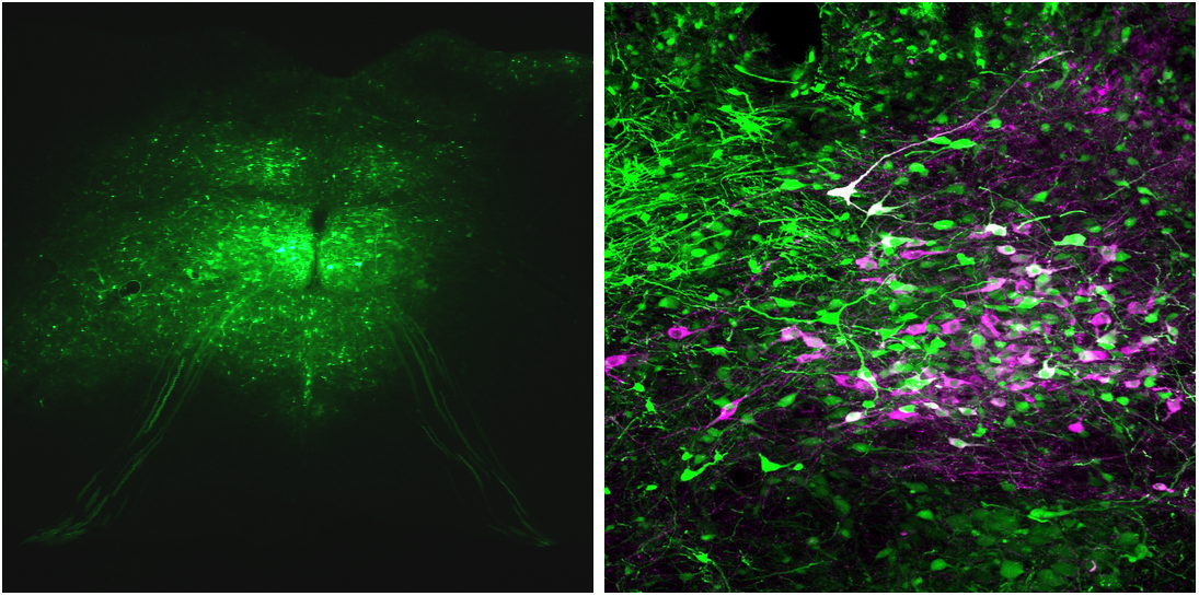 An example of unlabeled AAV sample images