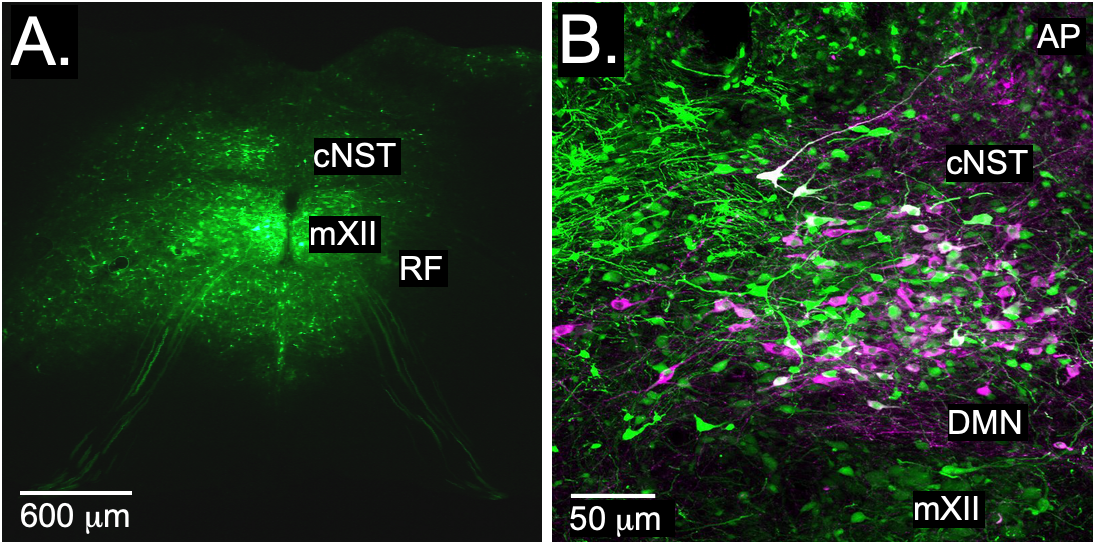 An example of labeled AAV sample images